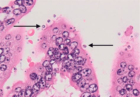  Cryptosporidium: Een microscopische parasiet die zich thuisvoelt in de darmen van zijn gastheer!