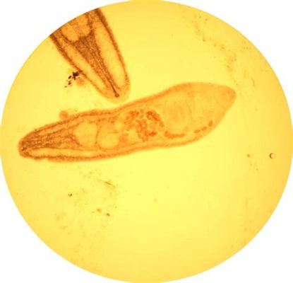  Ophthalmosomum: Een Parasitaire Platworm Met een Voorkeur voor Vissen en Amfibieën!